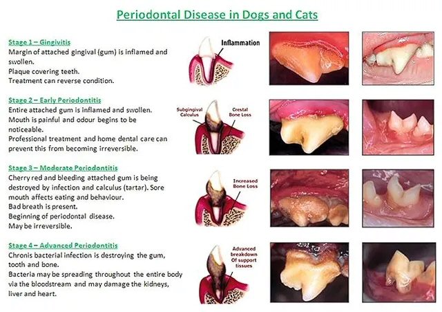 picture of stages of periodontal disease 