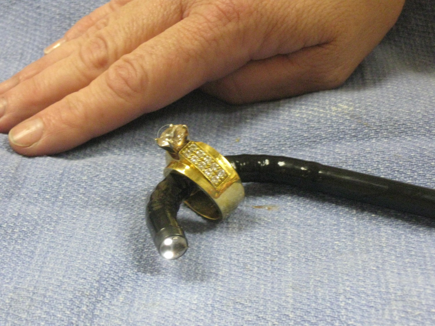 Over-sized wedding ring retrieved with endoscope