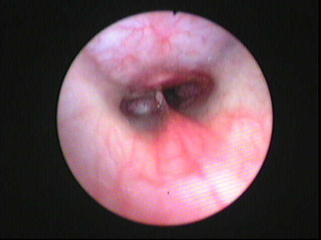 Rhinoscopy showing a pale tumor a dog's nasopharynx